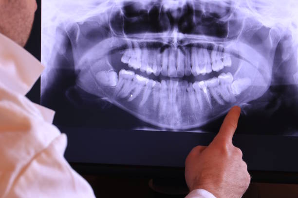 Best Emergency Dental Care for Abscessed Tooth in Stickney, IL