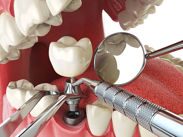 Best Emergency Dental Services for Seniors in Stickney, IL